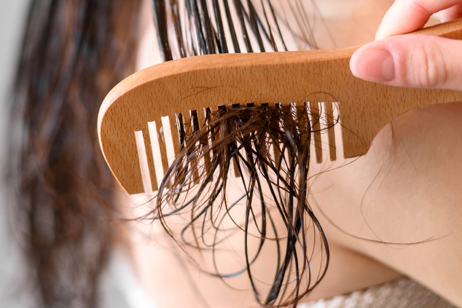hair fall and hair loss hair fall and hair loss